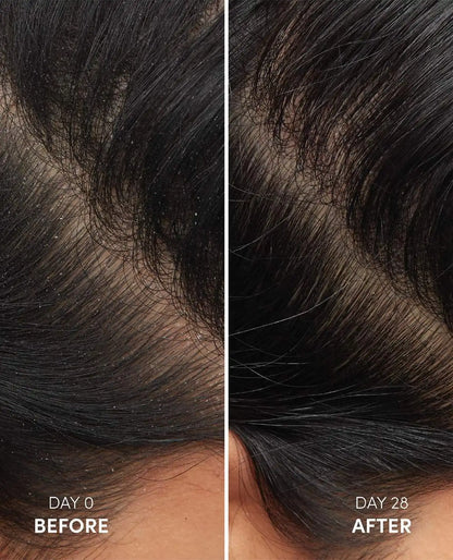 Anti-Dandruff Hair Shampoo