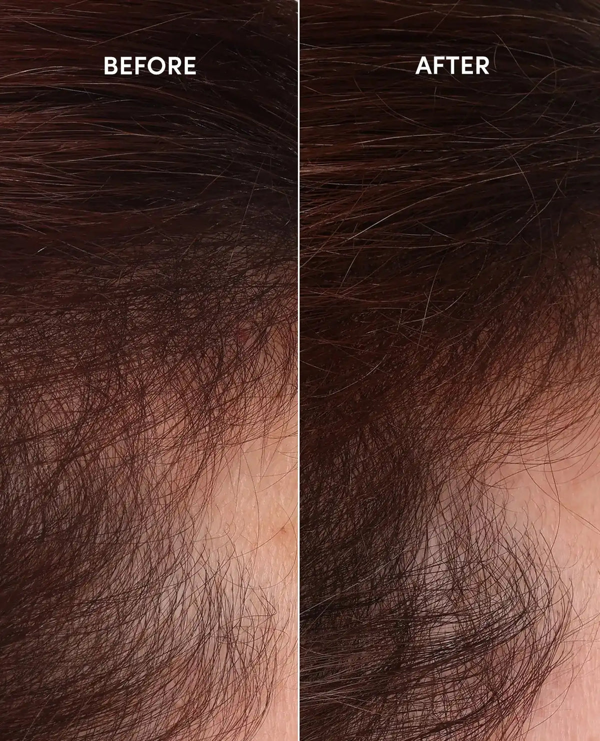 Scalp Serum